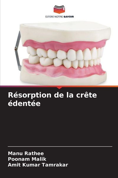 Produktbild: R&eacute;sorption de la cr&ecirc;te &eacute;dent&eacute;e