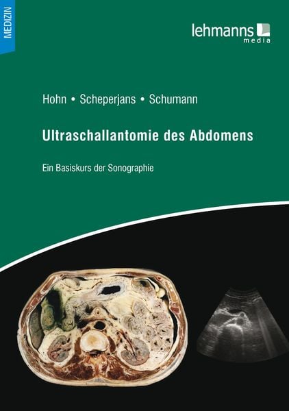 Produktbild: Ultraschallanatomie des Abdomens