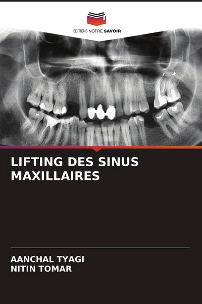 Produktbild: Lifting des Sinus Maxillaires