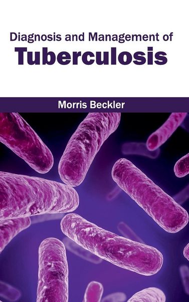 Produktbild: Diagnosis and Management of Tuberculosis