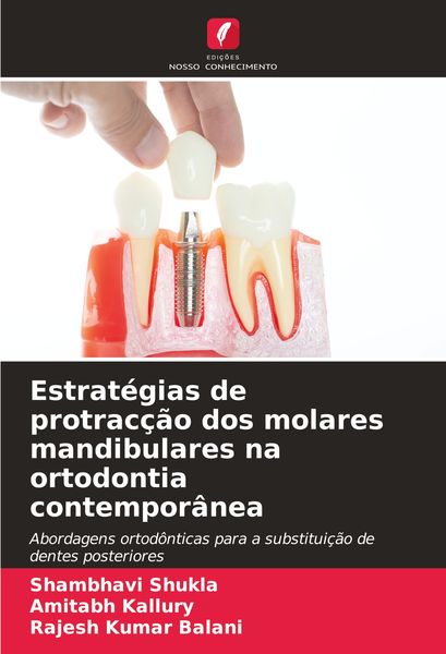 Produktbild: Estrat&eacute;gias de protrac&ccedil;&atilde;o dos molares mandibulares na ortodontia contempor&acirc;nea