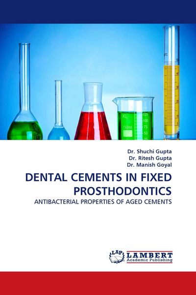 Produktbild: Dental Cements in Fixed Prosthodontics