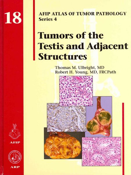 Produktbild: Thomas M. Ulbright: Tumors of the Testis and Adjacent Struc