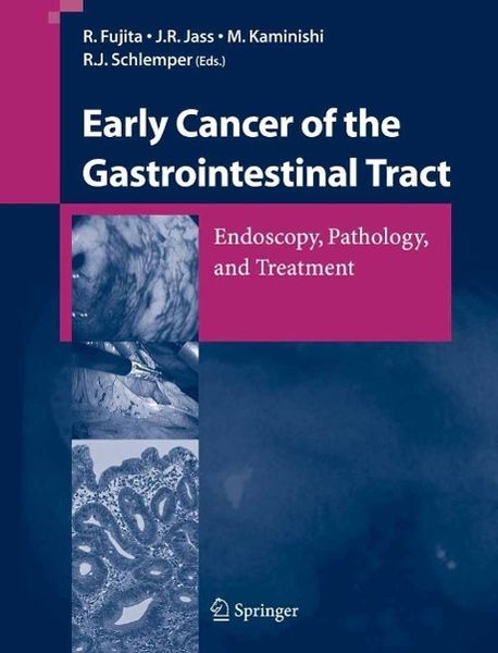 Produktbild: Early Cancer of the Gastrointestinal Tract