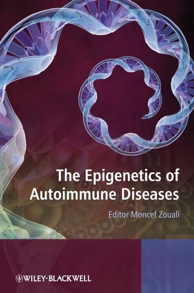 Produktbild: Epigenetics Of Autoimmune Dise