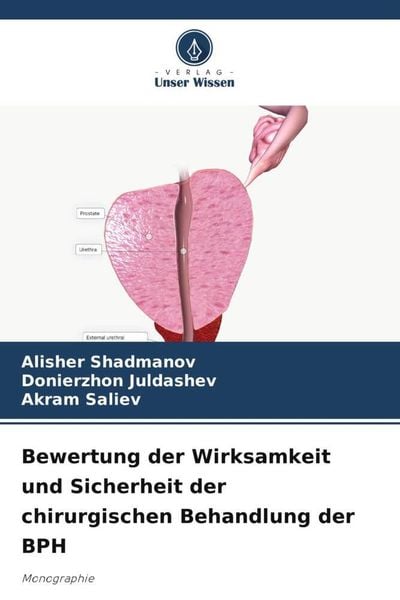Produktbild: Bewertung der Wirksamkeit und Sicherheit der chirurgischen Behandlung der BPH