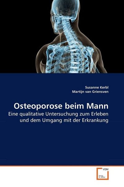 Produktbild: Kerbl, S: Osteoporose beim Mann