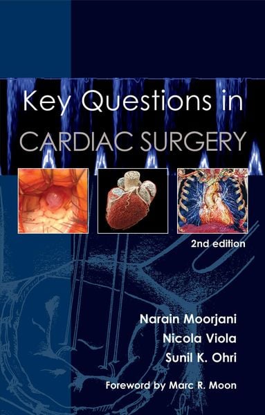 Produktbild: Key Questions in Cardiac Surgery, 2nd edition