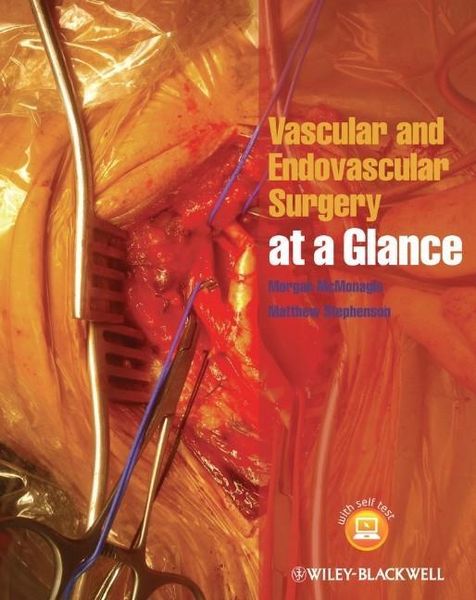 Produktbild: Vascular and Endovascular Surgery at a Glance