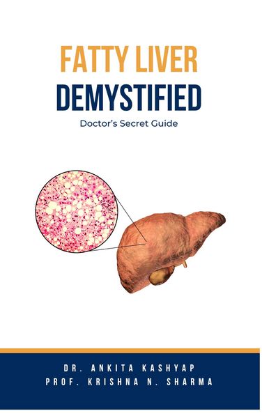 Produktbild: Fatty Liver Demystified: Doctor's Secret Guide