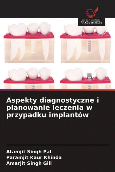 Produktbild: Aspekty diagnostyczne i planowanie leczenia w przypadku implant&oacute;w