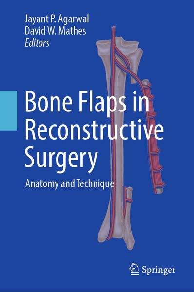 Produktbild: Bone Flaps in Reconstructive Surgery