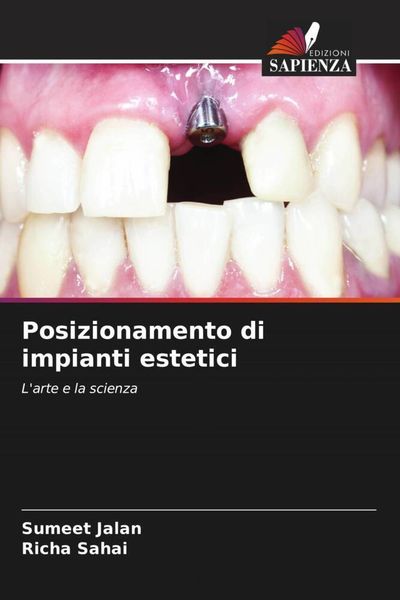 Produktbild: Posizionamento di impianti estetici