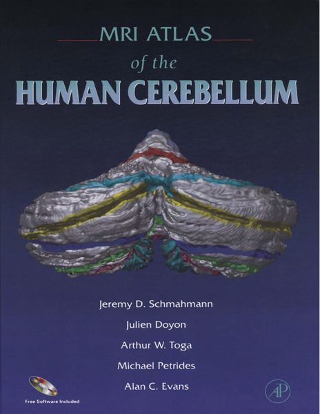 Produktbild: MRI Atlas of the Human Cerebellum