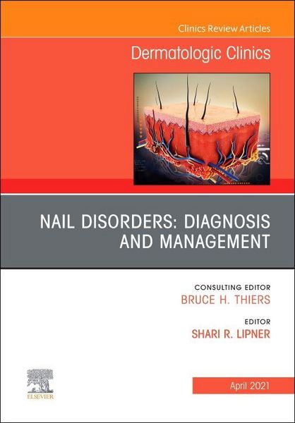 Produktbild: Nail Disorders: Diagnosis and Management, an Issue of Dermatologic Clinics