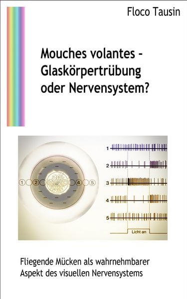 Produktbild: Mouches volantes - Glask&ouml;rpertr&uuml;bung oder Nervensystem?