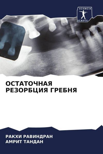 Produktbild: Ostatochnaya Rezorbciya Grebnya