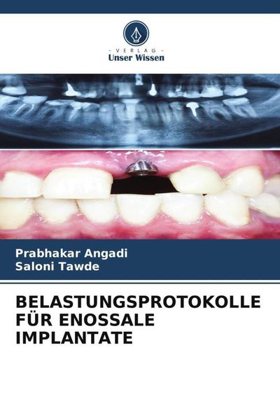 Produktbild: Belastungsprotokolle f&uuml;r Enossale Implantate