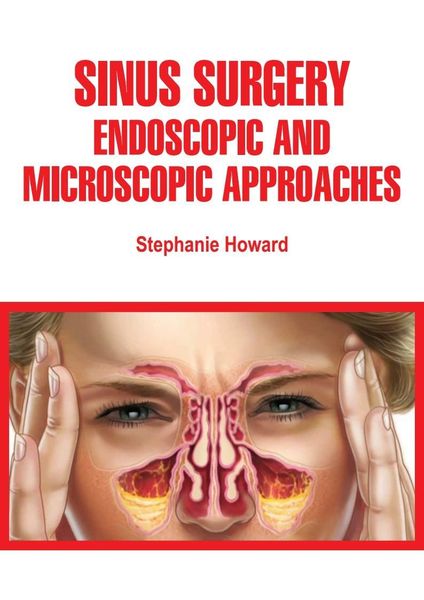 Produktbild: Sinus Surgery