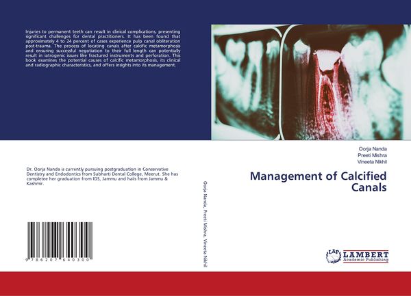Produktbild: Management of Calcified Canals