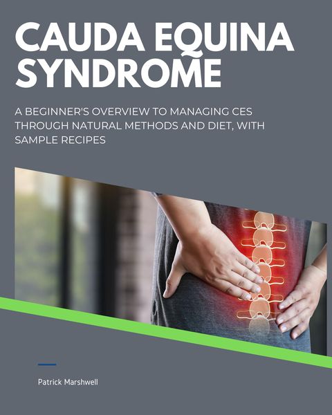 Produktbild: Cauda Equina Syndrome