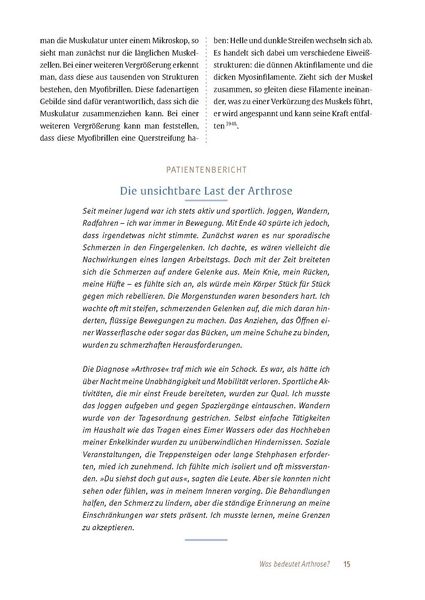 Produktbild: Arthrose