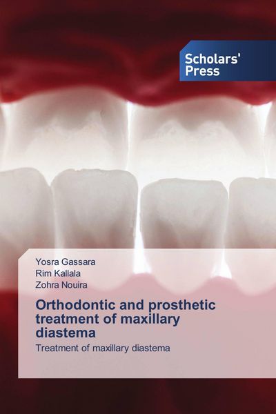 Produktbild: Orthodontic and prosthetic treatment of maxillary diastema