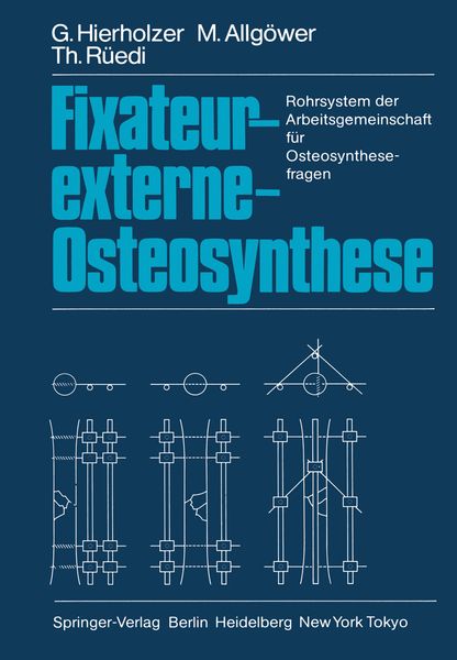 Produktbild: Fixateur-externe-Osteosynthese