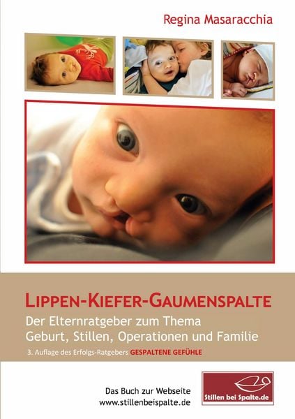 Produktbild: Lippen-Kiefer-Gaumenspalte