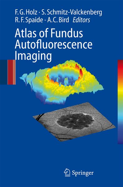 Produktbild: Atlas of Fundus Autofluorescence Imaging