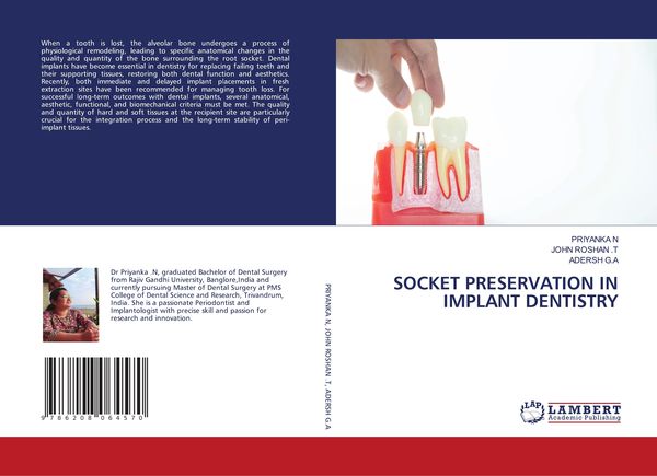 Produktbild: Socket Preservation in Implant Dentistry