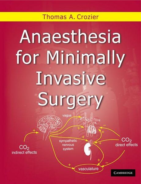 Produktbild: Anaesthesia for Minimally Invasive Surgery