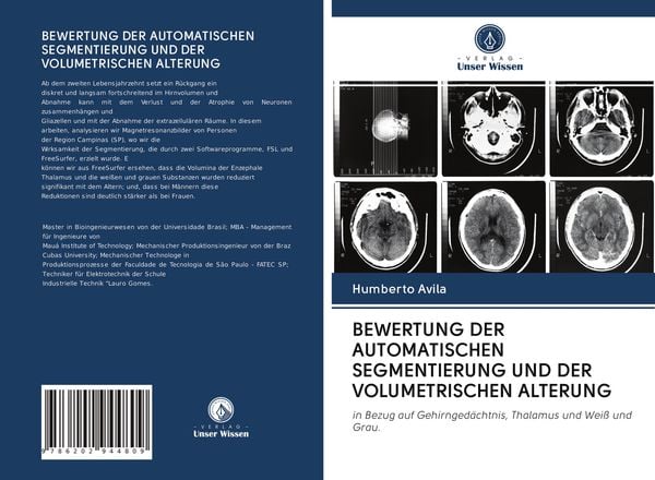 Produktbild: Bewertung der Automatischen Segmentierung und der Volumetrischen Alterung
