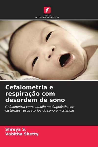 Produktbild: Cefalometria e respira&ccedil;&atilde;o com desordem de sono