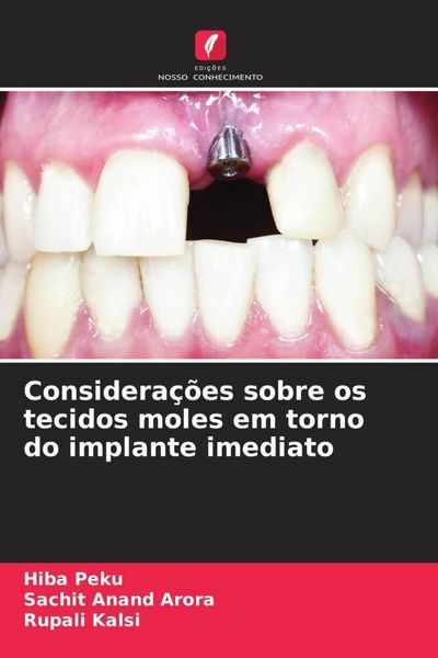 Produktbild: Considera&ccedil;&otilde;es sobre os tecidos moles em torno do implante imediato