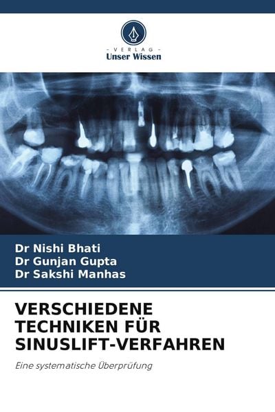 Verschiedene Techniken für Sinuslift-Verfahren, Taschenbuch von Nishi Bhati , Gunjan Gupta , Sakshi Manhas, Verlag Unser Wissen, 9786209563782