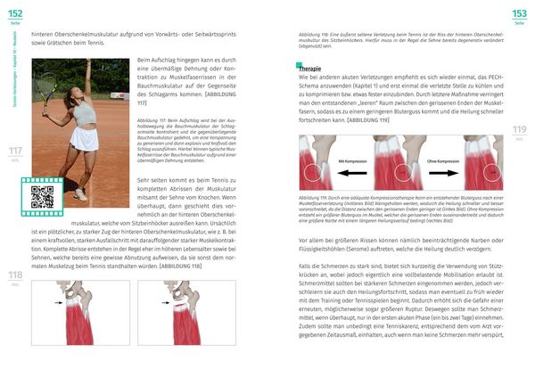 Produktbild: Tennis-Verletzungen