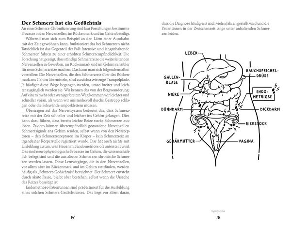 Produktbild: Endometriose-Sprechstunde
