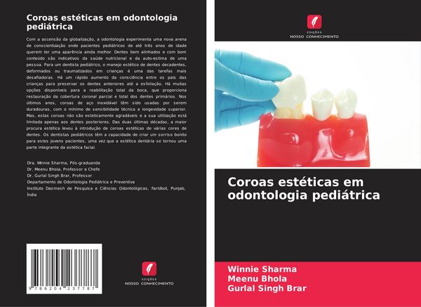 Produktbild: Coroas est&eacute;ticas em odontologia pedi&aacute;trica