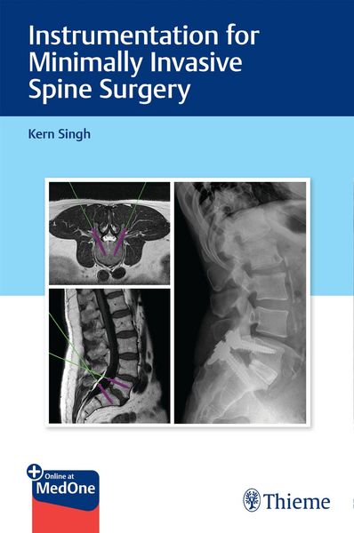 Produktbild: Instrumentation for Minimally Invasive Spine Surgery