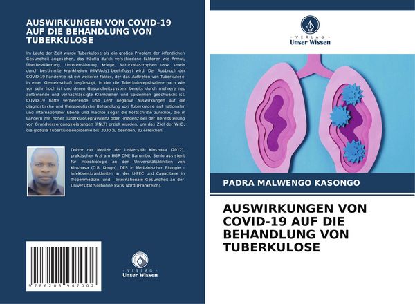 Produktbild: Auswirkungen von Covid-19 Auf die Behandlung von Tuberkulose