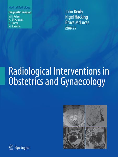 Produktbild: Radiological Interventions in Obstetrics and Gynaecology
