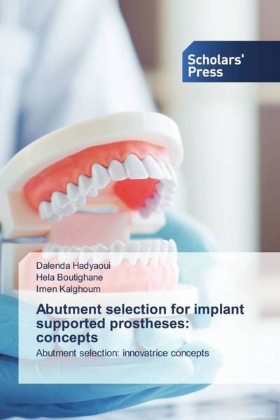 Produktbild: Abutment selection for implant supported prostheses: concepts