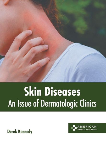 Produktbild: Skin Diseases: An Issue of Dermatologic Clinics