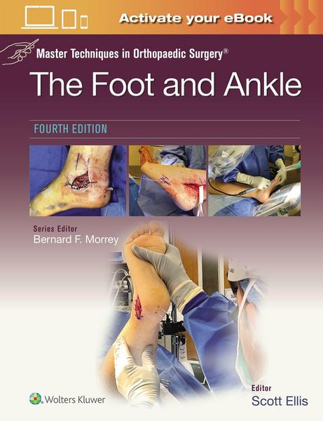 Produktbild: Master Techniques in Orthopaedic Surgery: The Foot and Ankle: Print + eBook with Multimedia