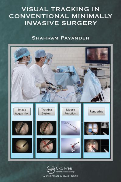Produktbild: Visual Tracking in Conventional Minimally Invasive Surgery