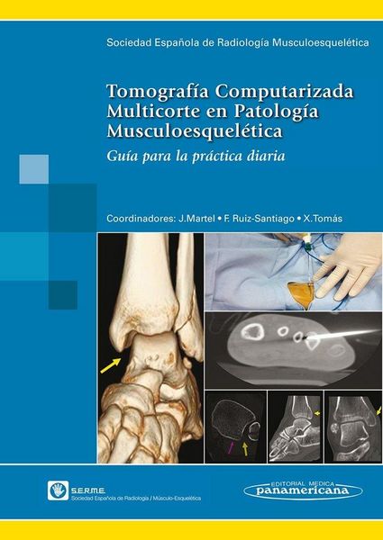 Produktbild: Tomograf&iacute;a computarizada multicorte en patolog&iacute;a musculoesquel&eacute;tica : gu&iacute;a para la pr&aacute;ctica diaria