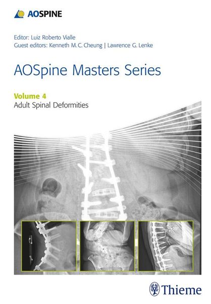Produktbild: AOSpine Masters Series, Volume 4: Adult Spinal Deformities