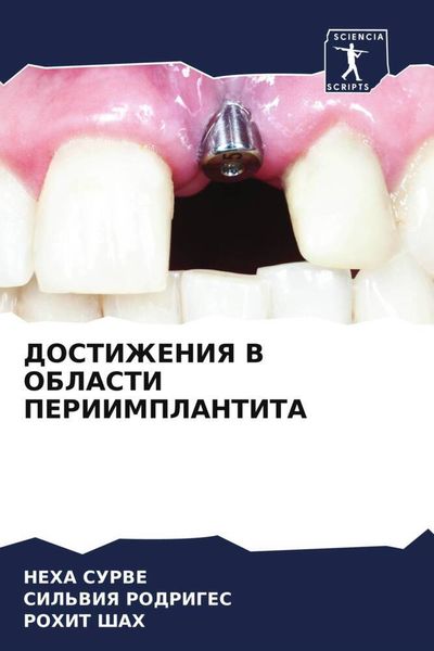 Produktbild: Dostizheniya V Oblasti Periimplantita