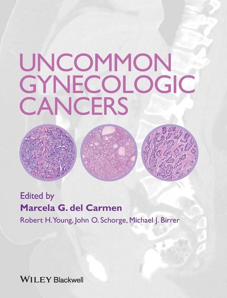 Produktbild: Uncommon Gynecologic Cancers